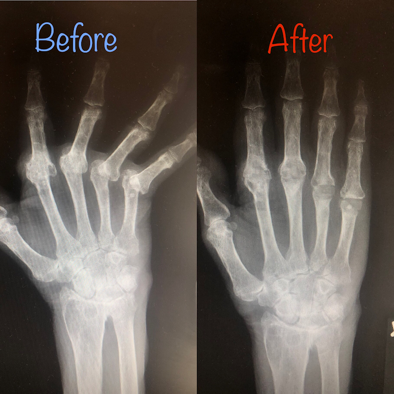 AJ Julka MD, Hand Wrist and Elbow Surgeon image 9